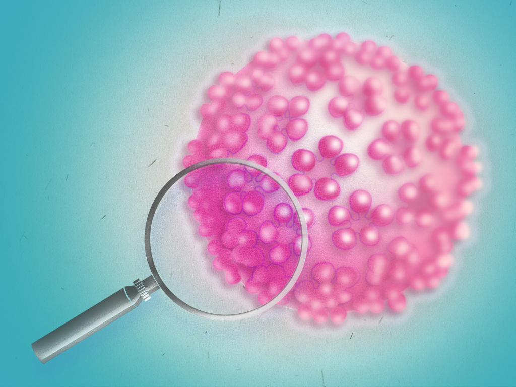 Virus del Papiloma Humano (VPH): La educación sexual vs los estigmas - Ilustración Viviana Mamani